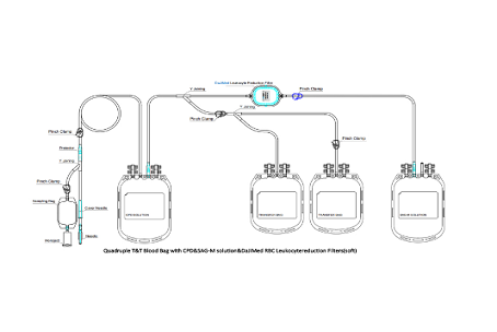 How Leukocyte Filters Prevent Transfusion-Associated Graft-versus-Host Disease